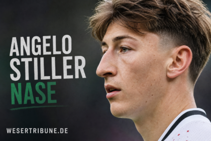 angelo stiller nase